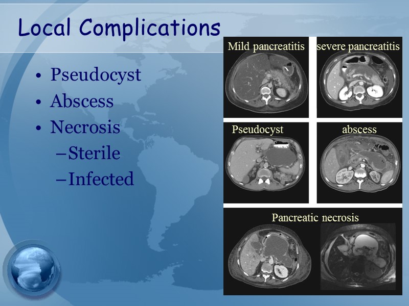 Local Complications Pseudocyst Abscess Necrosis Sterile Infected Mild pancreatitis severe pancreatitis Pseudocyst abscess Pancreatic